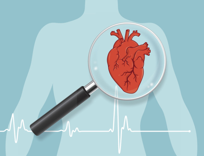 onderzoek naar hartaandoeningen